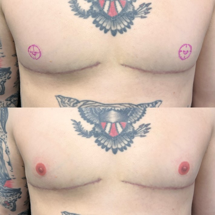 All sizes, Lonnie's 3rd Nipple Tattoo